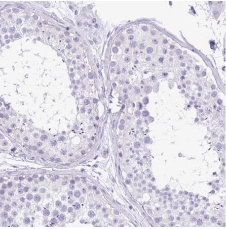 Immunohistochemistry (Formalin/PFA-fixed paraffin-embedded sections) - Anti-TMEM79 antibody - N-terminal (AB185453)