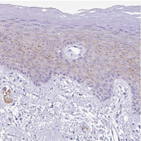 Immunohistochemistry (Formalin/PFA-fixed paraffin-embedded sections) - Anti-TMEM79 antibody - N-terminal (AB185453)