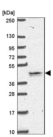 Western blot - Anti-TMEM79 antibody - N-terminal (AB185453)