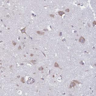 Immunohistochemistry (Formalin/PFA-fixed paraffin-embedded sections) - Anti-TMEM8C antibody (AB188300)