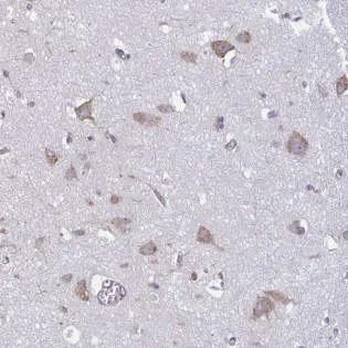 Immunohistochemistry (Formalin/PFA-fixed paraffin-embedded sections) - Anti-TMEM8C antibody (AB188300)