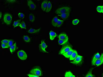 Immunocytochemistry/ Immunofluorescence - Anti-TMEM91 antibody (AB236864)