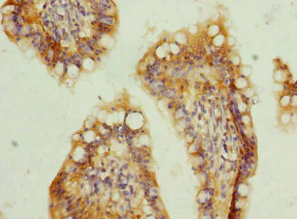 Immunohistochemistry (Formalin/PFA-fixed paraffin-embedded sections) - Anti-TMEM91 antibody (AB236864)