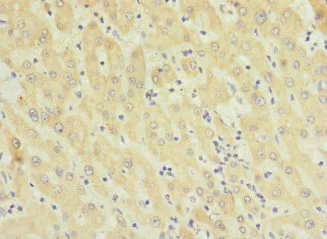 Immunohistochemistry (Formalin/PFA-fixed paraffin-embedded sections) - Anti-TMEM91 antibody (AB236864)