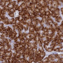 Immunohistochemistry (Formalin/PFA-fixed paraffin-embedded sections) - Anti-TMEM97 antibody (AB126490)