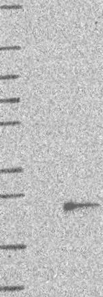 Western blot - Anti-TMEM97 antibody (AB126490), expandable thumbnail