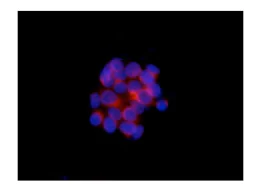 Immunocytochemistry/ Immunofluorescence - Anti-TMEM9B antibody [EPR14339] (AB189253)