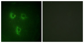 Immunocytochemistry/ Immunofluorescence - Anti-TMEPAI antibody (AB128006), expandable thumbnail