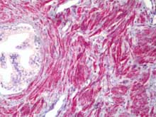 Immunohistochemistry (Formalin/PFA-fixed paraffin-embedded sections) - Anti-TMEPAI antibody (AB128006), expandable thumbnail