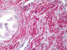 Immunohistochemistry (Formalin/PFA-fixed paraffin-embedded sections) - Anti-TMEPAI antibody (AB128006)