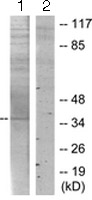 Western blot - Anti-TMEPAI antibody (AB128006), expandable thumbnail