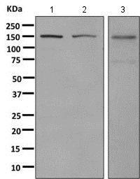 Western blot - Anti-TMF antibody [EPR10671(B)] - BSA and Azide free (AB249024), expandable thumbnail