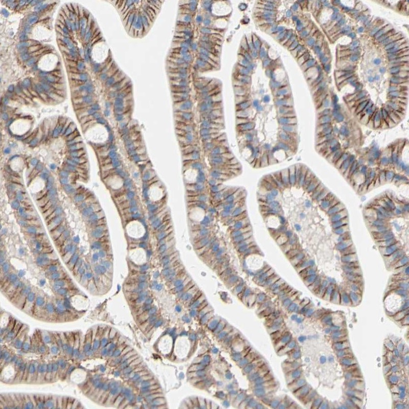 Immunohistochemistry (Formalin/PFA-fixed paraffin-embedded sections) - Anti-TMIGD2/IGPR1 antibody (AB121333)
