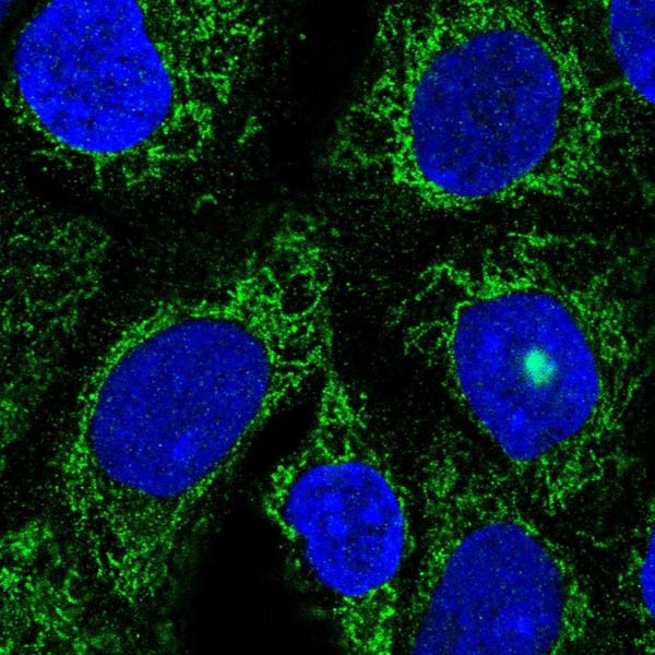 Immunocytochemistry/ Immunofluorescence - Anti-TMLHE antibody (AB220232)