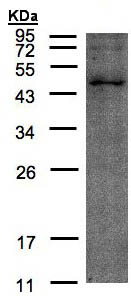 Western blot - Anti-TMLHE antibody (AB97842)