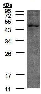 Western blot - Anti-TMLHE antibody (AB97842)