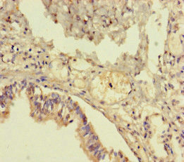 Immunohistochemistry (Formalin/PFA-fixed paraffin-embedded sections) - Anti-TMM64 antibody (AB222842)