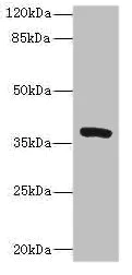 Western blot - Anti-TMM64 antibody (AB222842)