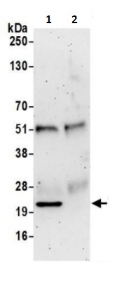 Immunoprecipitation - Anti-TMP21 antibody (AB241308), expandable thumbnail