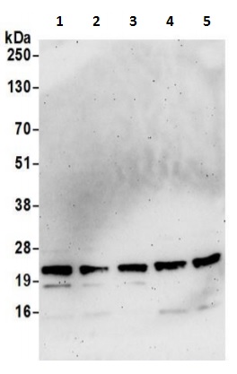 Western blot - Anti-TMP21 antibody (AB241308), expandable thumbnail