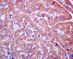 Immunohistochemistry (Formalin/PFA-fixed paraffin-embedded sections) - Anti-TMP21 antibody [EPR9036(B)] (AB134948)