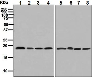 Western blot - Anti-TMP21 antibody [EPR9037(B)] (AB133771)