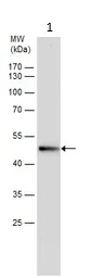Western blot - Anti-TMPRSS11D antibody (AB127031)