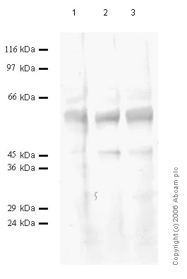 Western blot - Anti-TMPRSS13 antibody - Cytoplasmic domain (AB59862)