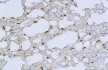 Immunohistochemistry (Formalin/PFA-fixed paraffin-embedded sections) - Anti-TMPRSS2 antibody (AB214462)