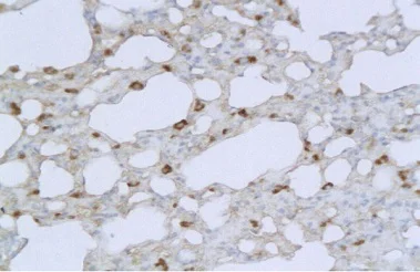 Immunohistochemistry (Formalin/PFA-fixed paraffin-embedded sections) - Anti-TMPRSS2 antibody (AB214462)