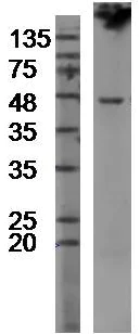 Western blot - Anti-TMPRSS2 antibody (AB214462)