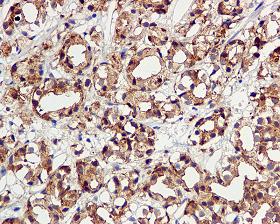 Immunohistochemistry (Formalin/PFA-fixed paraffin-embedded sections) - Anti-TMPRSS2 antibody [EPR3862] (AB109131), expandable thumbnail