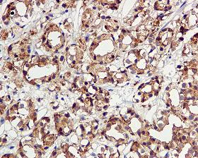 Immunohistochemistry (Formalin/PFA-fixed paraffin-embedded sections) - Anti-TMPRSS2 antibody [EPR3862] (AB109131)