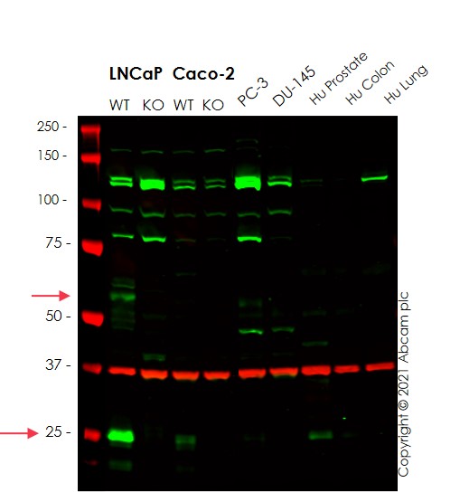 Western blot - Anti-TMPRSS2 antibody [EPR3862] (AB109131), expandable thumbnail