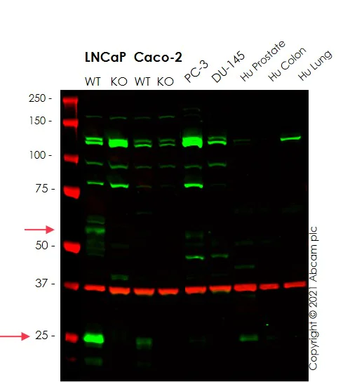 Western blot - Anti-TMPRSS2 antibody [EPR3862] (AB109131)