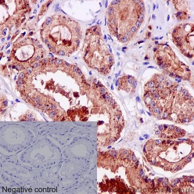 Immunohistochemistry (Formalin/PFA-fixed paraffin-embedded sections) - Anti-TMPRSS2 antibody [EPR3862] - BSA and Azide free (AB242384)