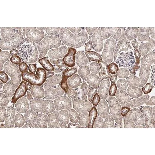 Immunohistochemistry (Formalin/PFA-fixed paraffin-embedded sections) - Anti-TMPRSS2 antibody [HL2279] (AB317187)