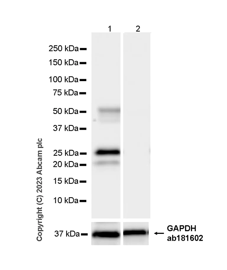 Western blot - Anti-TMPRSS2 antibody [P5H9-A3] - BSA and Azide free (AB309547)