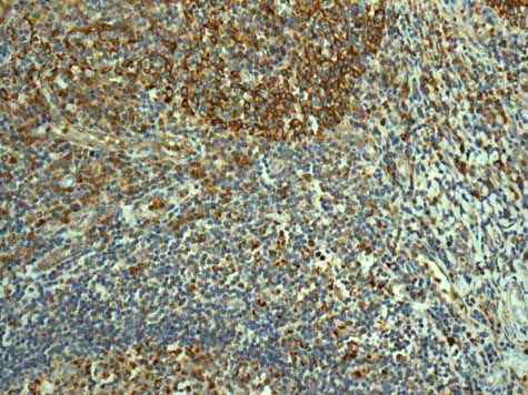 Immunohistochemistry (Formalin/PFA-fixed paraffin-embedded sections) - Anti-TMPRSS3 antibody [EPR7048] - BSA and Azide free (AB249403), expandable thumbnail