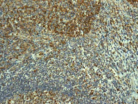 Immunohistochemistry (Formalin/PFA-fixed paraffin-embedded sections) - Anti-TMPRSS3 antibody [EPR7048] - BSA and Azide free (AB249403)