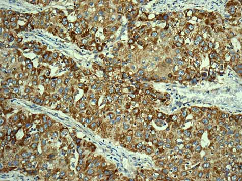 Immunohistochemistry (Formalin/PFA-fixed paraffin-embedded sections) - Anti-TMPRSS3 antibody [EPR7048] - BSA and Azide free (AB249403), expandable thumbnail