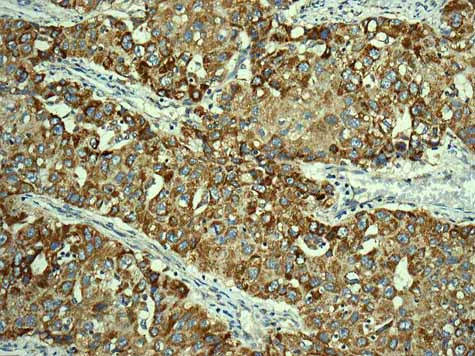 Immunohistochemistry (Formalin/PFA-fixed paraffin-embedded sections) - Anti-TMPRSS3 antibody [EPR7048] - BSA and Azide free (AB249403)