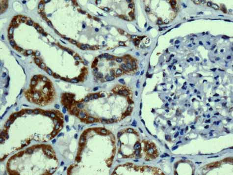 Immunohistochemistry (Formalin/PFA-fixed paraffin-embedded sections) - Anti-TMPRSS3 antibody [EPR7048] - BSA and Azide free (AB249403), expandable thumbnail