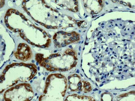Immunohistochemistry (Formalin/PFA-fixed paraffin-embedded sections) - Anti-TMPRSS3 antibody [EPR7048] - BSA and Azide free (AB249403)