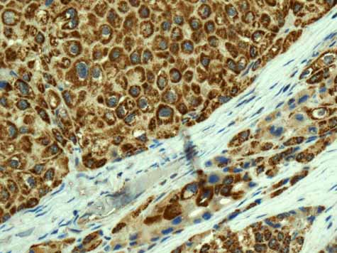 Immunohistochemistry (Formalin/PFA-fixed paraffin-embedded sections) - Anti-TMPRSS3 antibody [EPR7048] - BSA and Azide free (AB249403), expandable thumbnail