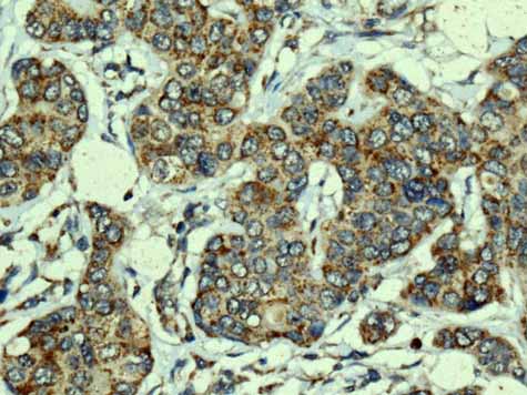 Immunohistochemistry (Formalin/PFA-fixed paraffin-embedded sections) - Anti-TMPRSS3 antibody [EPR7048] - BSA and Azide free (ab249403), expandable thumbnail