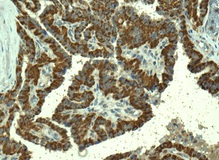 Immunohistochemistry (Formalin/PFA-fixed paraffin-embedded sections) - Anti-TMPRSS3 antibody [EPR7048] - BSA and Azide free (ab249403), expandable thumbnail