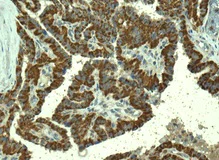 Immunohistochemistry (Formalin/PFA-fixed paraffin-embedded sections) - Anti-TMPRSS3 antibody [EPR7048] - BSA and Azide free (AB249403)