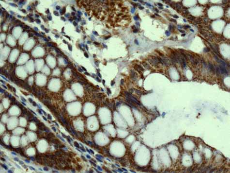 Immunohistochemistry (Formalin/PFA-fixed paraffin-embedded sections) - Anti-TMPRSS3 antibody [EPR7048] - BSA and Azide free (AB249403), expandable thumbnail