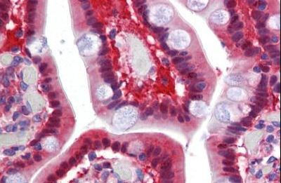 Immunohistochemistry (Formalin/PFA-fixed paraffin-embedded sections) - Anti-TMPRSS4 antibody (AB150595)